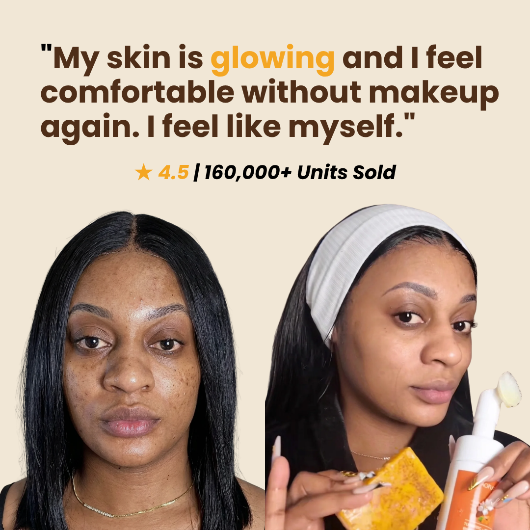 Kojic Acid Dark Spot Remover Face & Body Set